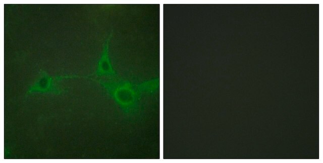 Anti-ADAM 17, C-Terminal antibody produced in rabbit affinity isolated antibody