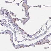 Anti-CACNA2D2 antibody produced in rabbit Prestige Antibodies&#174; Powered by Atlas Antibodies, affinity isolated antibody, buffered aqueous glycerol solution
