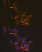 Anti-Tubulin beta-1 chain Antibody, clone 2Z6P1, Rabbit Monoclonal