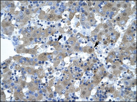 Anti-KIF5B (AB1) antibody produced in rabbit affinity isolated antibody