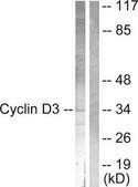 Anti-Cyclin D3 antibody produced in rabbit affinity isolated antibody