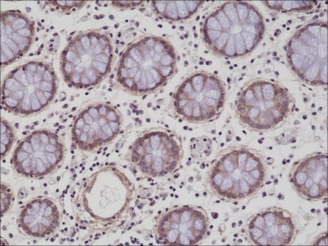 Anti-CD29 antibody, Rabbit Monoclonal recombinant, expressed in HEK 293 cells, clone RM285, purified immunoglobulin