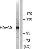 Anti-HDAC9 antibody produced in rabbit affinity isolated antibody