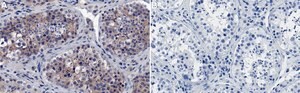 Anti-PI3 Kinase p110 β Antibody, clone 1D18 ZooMAb&#174; Rabbit Monoclonal recombinant, expressed in HEK 293 cells