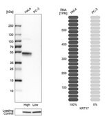 Anti-KRT17 antibody produced in rabbit Ab2, Prestige Antibodies&#174; Powered by Atlas Antibodies, affinity isolated antibody, buffered aqueous glycerol solution