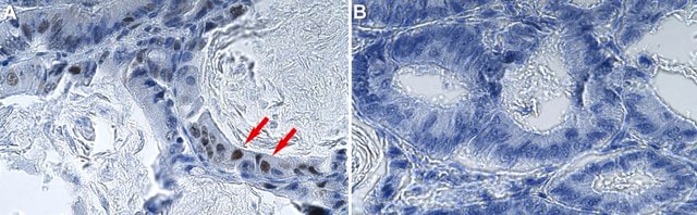 Anti-phospho-p38 (T180/Y182) Antibody, clone 2B7 ZooMAb&#174; Rabbit Monoclonal recombinant, expressed in HEK 293 cells