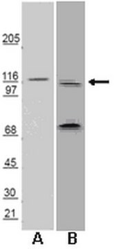 Anti-Huntingtin-Interacting Protein 1 Related (HIP1R) Antibody Chemicon&#174;, from rabbit