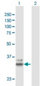 Anti-PPT1 antibody produced in rabbit purified immunoglobulin, buffered aqueous solution