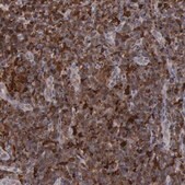 Anti-STAT1 antibody produced in rabbit Ab1, Prestige Antibodies&#174; Powered by Atlas Antibodies, affinity isolated antibody, buffered aqueous glycerol solution