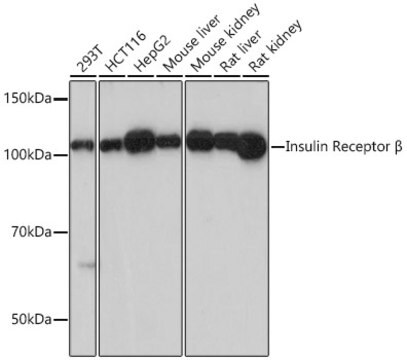 Anti-Insulin Receptor Antibody, clone 1F1B6, Rabbit Monoclonal