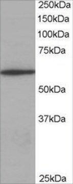 Anti-Coronin 1/TACO antibody produced in goat affinity isolated antibody, buffered aqueous solution