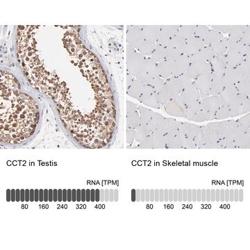 Anti-CCT2 antibody produced in rabbit Ab1, Prestige Antibodies&#174; Powered by Atlas Antibodies, affinity isolated antibody, buffered aqueous glycerol solution