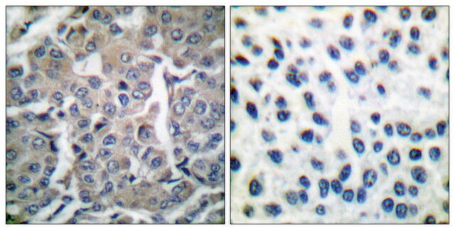 Anti-Acetyl-CoA Carboxylase, N-Terminal antibody produced in rabbit affinity isolated antibody