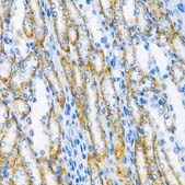 Anti-POLB antibody produced in rabbit