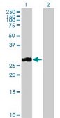 Anti-MMP7 antibody produced in rabbit purified immunoglobulin, buffered aqueous solution