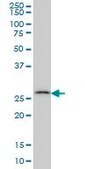 Monoclonal Anti-CA7 antibody produced in mouse clone 3B7, purified immunoglobulin, buffered aqueous solution