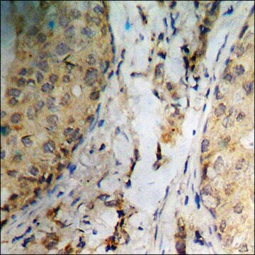 Anti-phospho-Catenin-&#946; (pSer37) antibody produced in rabbit affinity isolated antibody