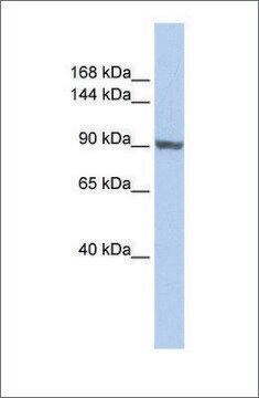 Anti-TNNI3K antibody produced in rabbit affinity isolated antibody