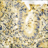 Anti-phospho-PYK2 (pTyr881) antibody produced in rabbit affinity isolated antibody