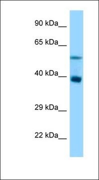 Anti-TRIM7 antibody produced in rabbit affinity isolated antibody