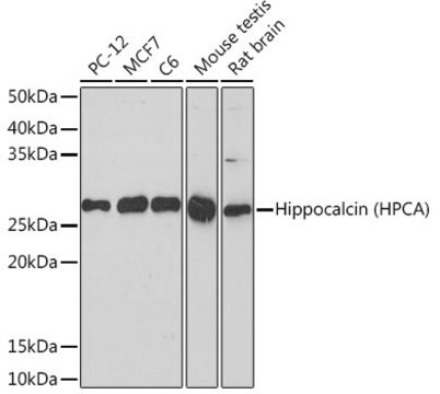 Anti-Hippocalcin (HPCA) Antibody, clone 6N2A6, Rabbit Monoclonal