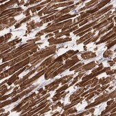 Monoclonal Anti-MYH6 antibody produced in mouse Prestige Antibodies&#174; Powered by Atlas Antibodies, clone CL2148, purified immunoglobulin, buffered aqueous glycerol solution