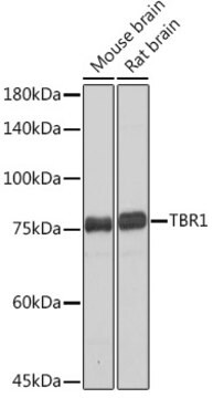 Anti-TBR1 Antibody, clone 1U1K5, Rabbit Monoclonal