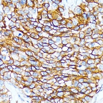 Anti-CD239/BCAM antibody produced in rabbit