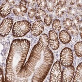 Anti-SLC9A1 antibody produced in rabbit Prestige Antibodies&#174; Powered by Atlas Antibodies, affinity isolated antibody, buffered aqueous glycerol solution