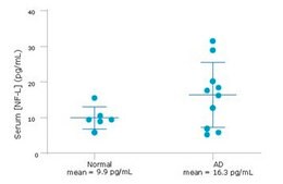 SMC&#174; Human NF-L High Sensitivity Immunoassay Kit kit sufficient for 96 wells