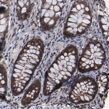 Anti-KIAA2026 antibody produced in rabbit Prestige Antibodies&#174; Powered by Atlas Antibodies, affinity isolated antibody, buffered aqueous glycerol solution
