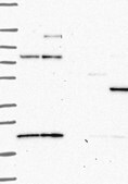 Anti-PRKAR2B antibody produced in rabbit Prestige Antibodies&#174; Powered by Atlas Antibodies, affinity isolated antibody, buffered aqueous glycerol solution