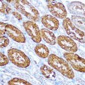Anti- CASP1 antibody produced in rabbit