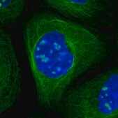 Anti-MAP2K5 antibody produced in rabbit Prestige Antibodies&#174; Powered by Atlas Antibodies, affinity isolated antibody, buffered aqueous glycerol solution, ab1