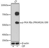 Anti-Phospho-PKA RII&#945; (PRKAR2A)-S99 antibody produced in rabbit