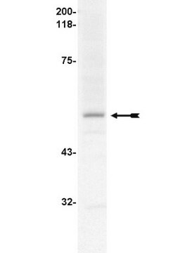 Anti-Fc&#949;RI &#945; subunit Antibody Upstate&#174;, from mouse