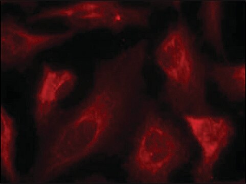 Anti-phospho-TP53 (pSer33) antibody produced in rabbit affinity isolated antibody
