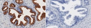 Anti-TIMP-1 Antibody, clone 1H19 ZooMAb&#174; Rabbit Monoclonal recombinant, expressed in HEK 293 cells