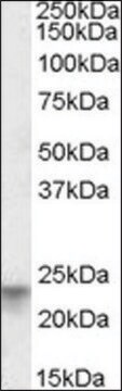Anti-TSPAN8 antibody produced in goat affinity isolated antibody, buffered aqueous solution