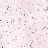 Monoclonal Anti-Bcl11A Antibody Produced In Mouse Prestige Antibodies&#174; Powered by Atlas Antibodies, clone CL13501, affinity isolated antibody, buffered aqueous glycerol solution