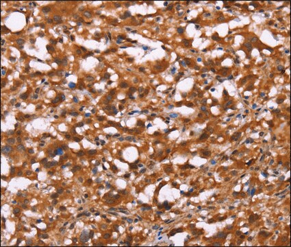 Anti-BRK1 antibody produced in rabbit affinity isolated antibody