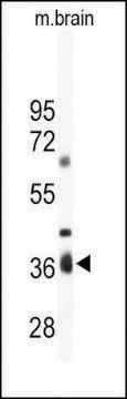 Anti-ART4 (C-term) antibody produced in rabbit IgG fraction of antiserum, buffered aqueous solution