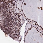 Anti-HDAC8 antibody produced in rabbit Prestige Antibodies&#174; Powered by Atlas Antibodies, affinity isolated antibody, buffered aqueous glycerol solution