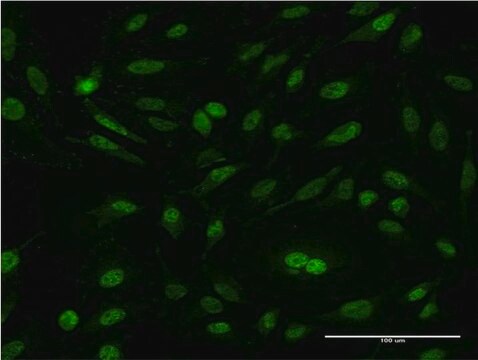 Monoclonal Anti-CSE1L antibody produced in mouse clone 1C1, purified immunoglobulin, buffered aqueous solution