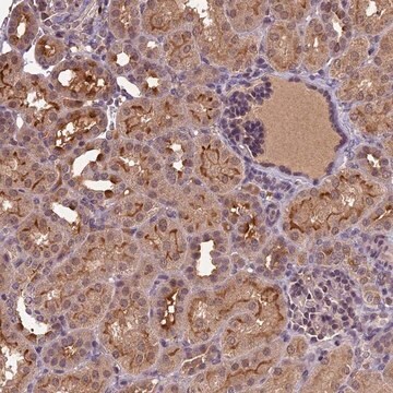 Anti-ATP10A antibody produced in rabbit Prestige Antibodies&#174; Powered by Atlas Antibodies, affinity isolated antibody, buffered aqueous glycerol solution