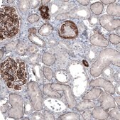 Monoclonal Anti-LAMA5 antibody produced in mouse Prestige Antibodies&#174; Powered by Atlas Antibodies, clone CL3118, purified immunoglobulin, buffered aqueous glycerol solution