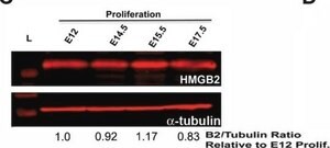 Anti-Tubulin Antibody, beta III isoform, CT, clone TU-20 (Similar to TUJ1) ascites fluid, clone TU-20 (Similar to TUJ1), Chemicon&#174;