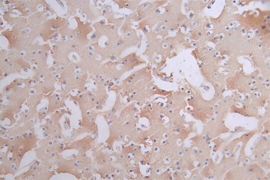 Anti-phospho-MAPT (S404) antibody, clone 11H10, Rabbit Monoclonal recombinant, expressed in HEK293F cells