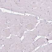 Anti-PLA2G1B antibody produced in rabbit Prestige Antibodies&#174; Powered by Atlas Antibodies, affinity isolated antibody, buffered aqueous glycerol solution