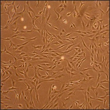 Human Chondrocytes - Osteoarthritis: HC-OA, adult